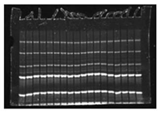 FirstLight UV Illuminator by UVP