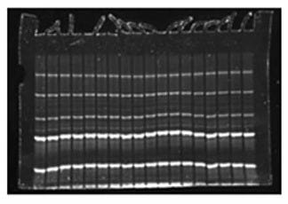 FirstLight UV Illuminator by UVP