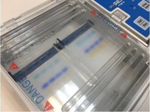 Gel Electrophoresis Stain: What to Use?