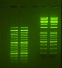 electrophoresis-gel