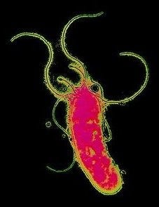 Helicobacter pylori bacterium, magnified.